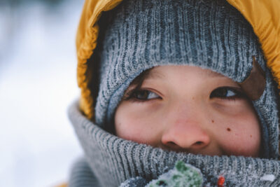 Caring for children's skin in winter