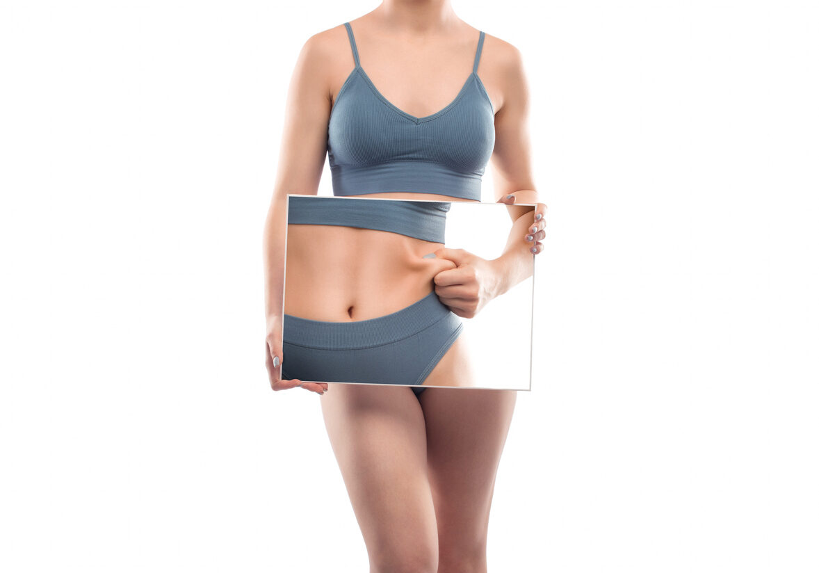 Girl pulls the skin on the abdomen, showing the body fat. Treatment and disposal of excess weight, the deposition of subcutaneous fat.